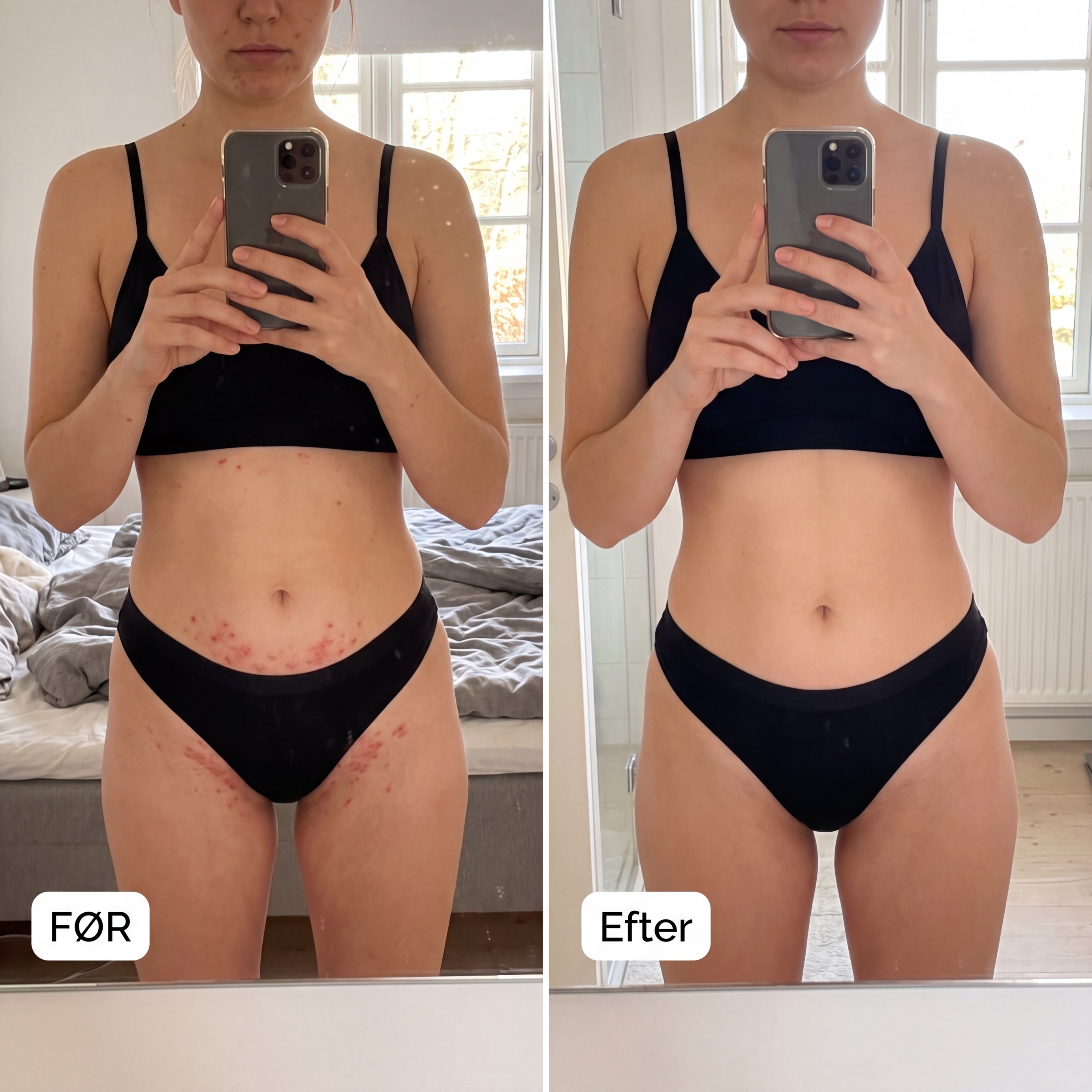 Sofie &mdash; f&oslash;r og efter ShaveSafe, bikinilinje